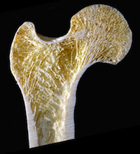 Model of proximal femur